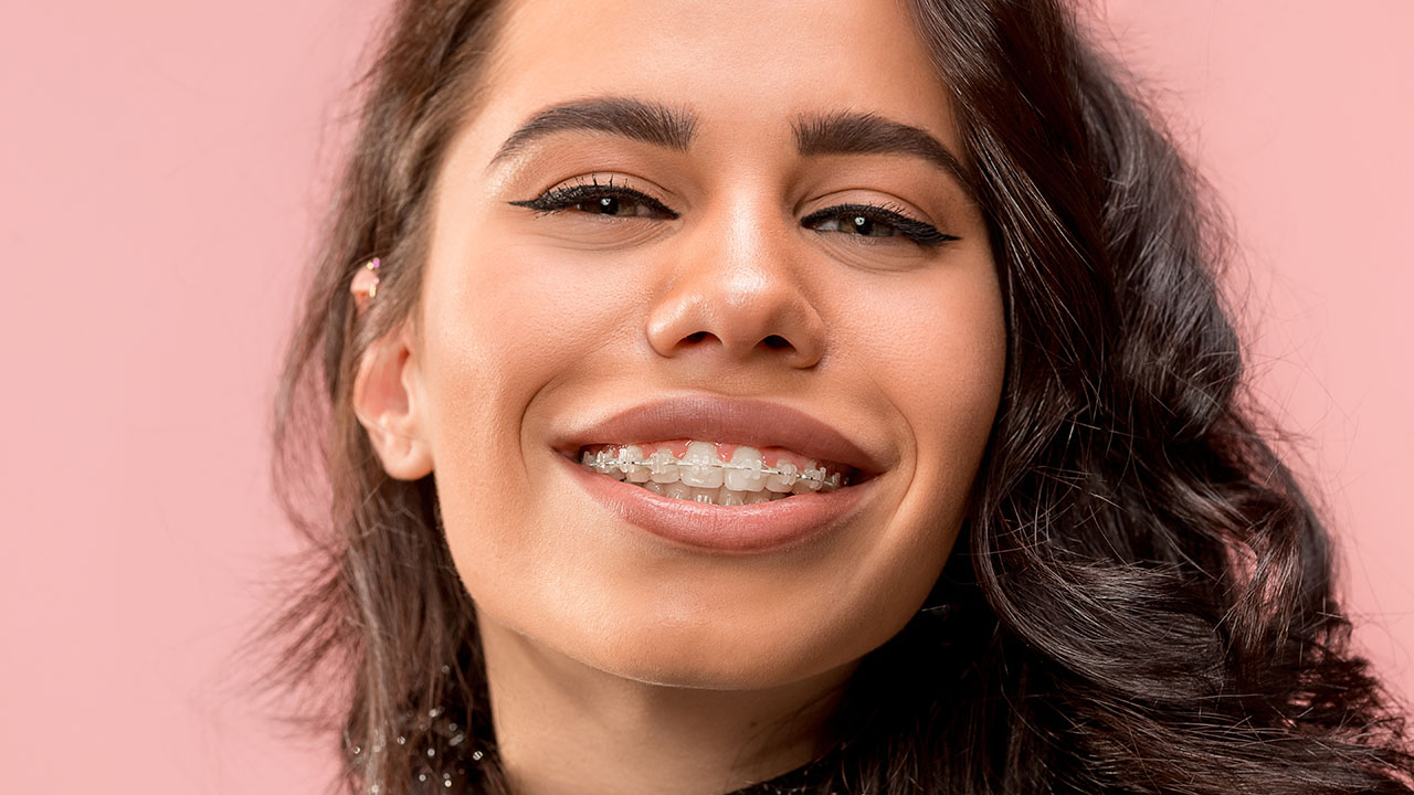 Clear Ceramic Braces Orthodontist